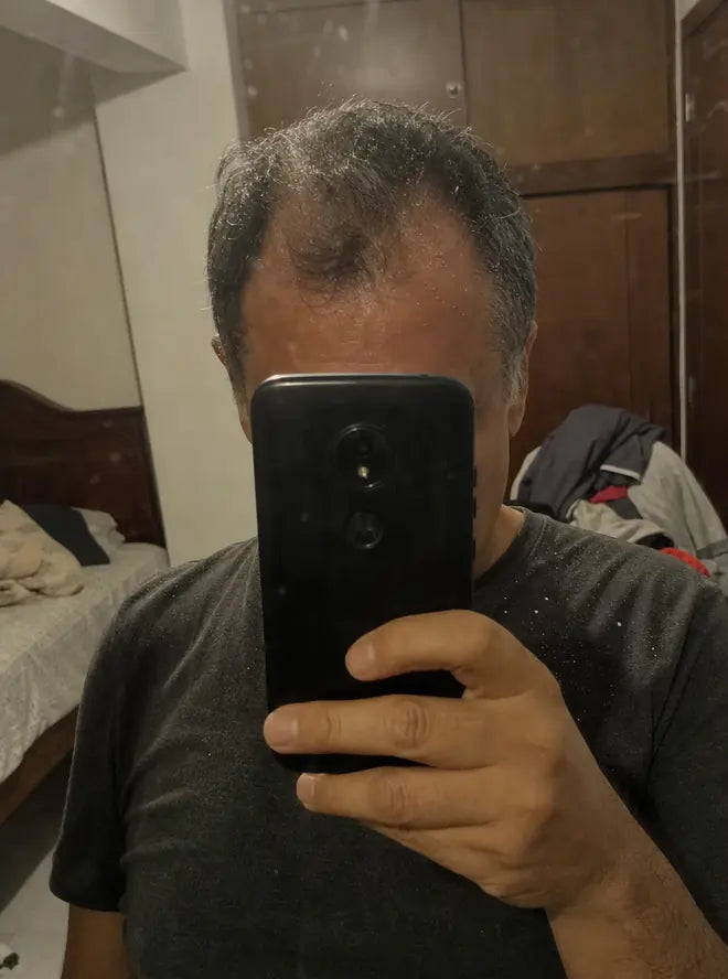 Antes