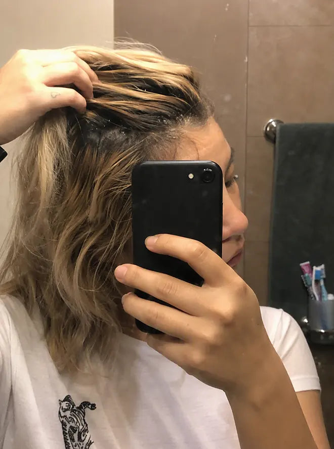 Antes