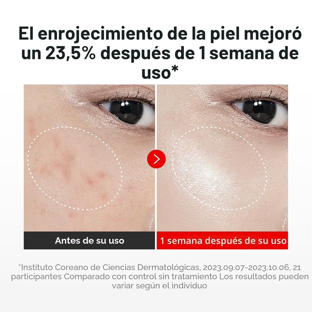 Menos rojeces en una semana
