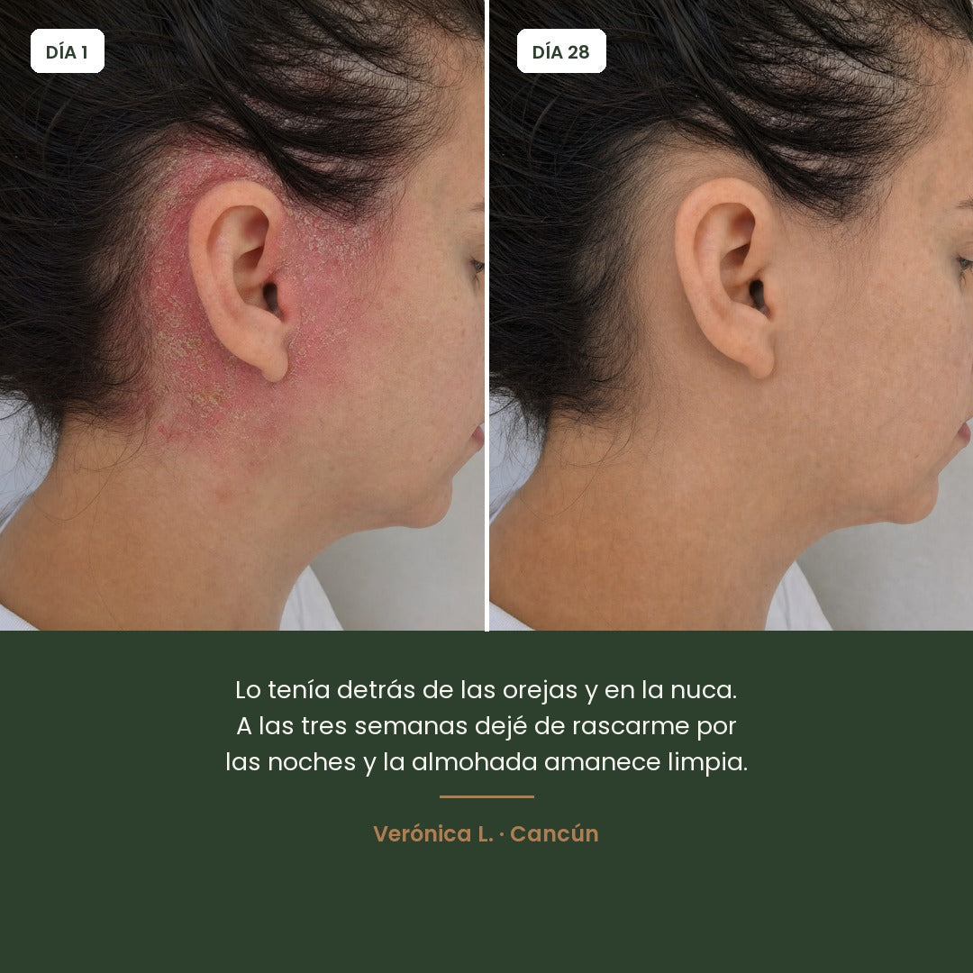 Antes y despues