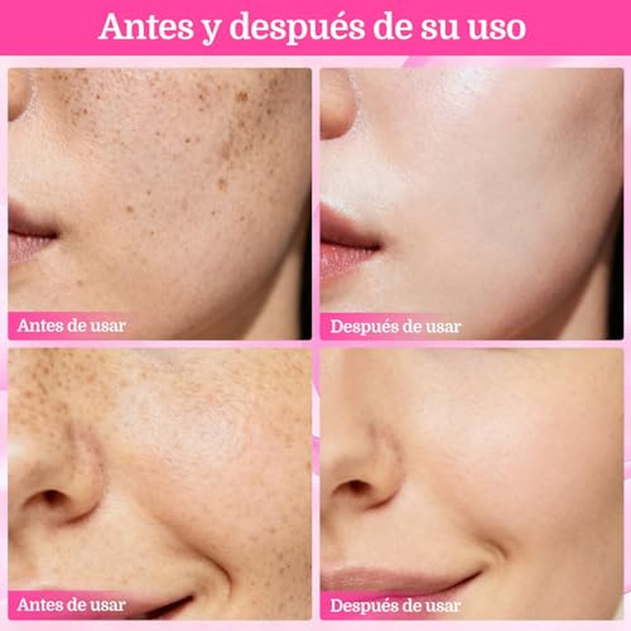 Antes y despu&eacute;s de cuatro semanas
