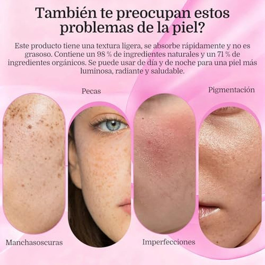Manchas, pecas, melasma e imperfecciones