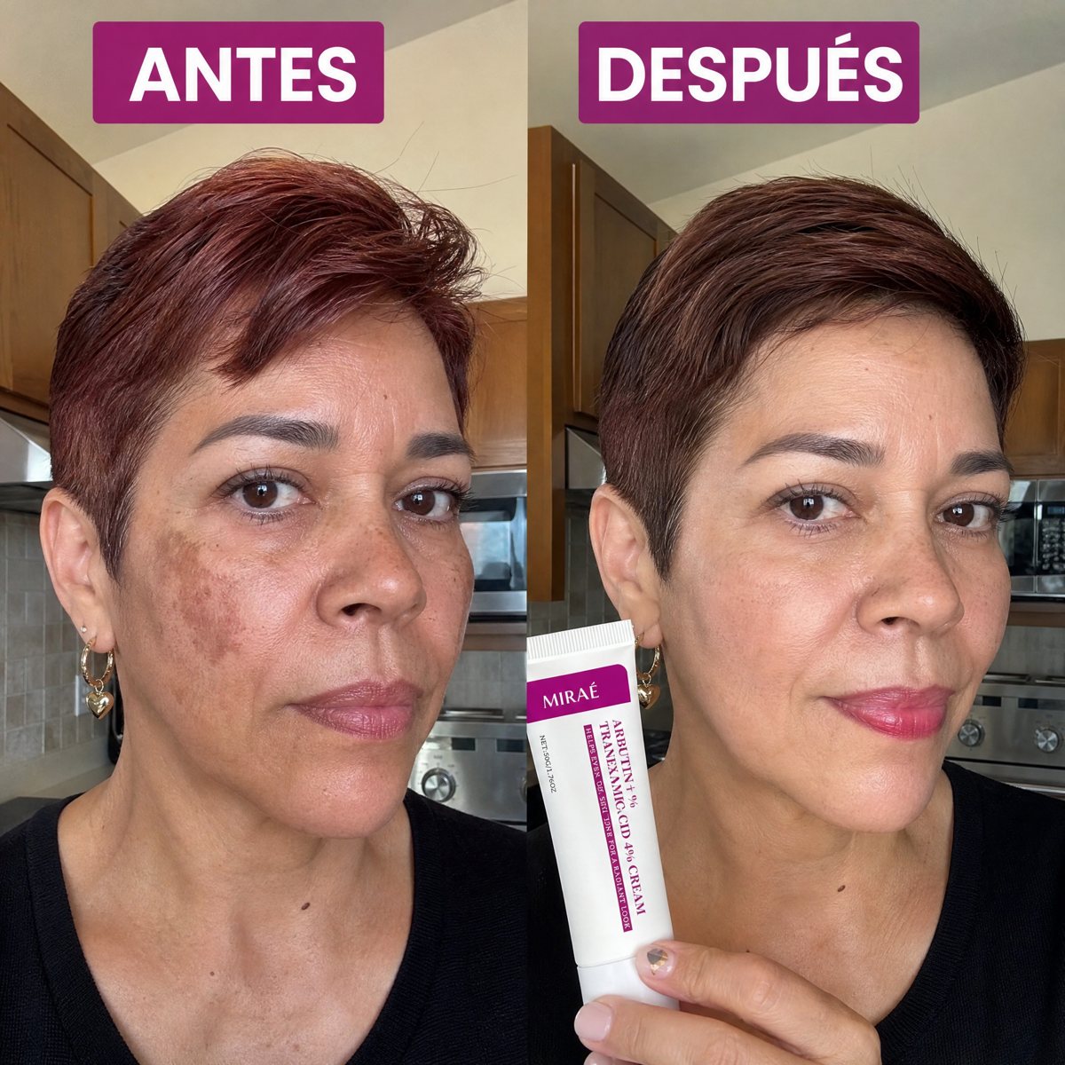 Norma antes y después