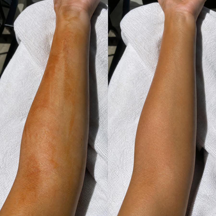 Fake tan versus Sunberry
