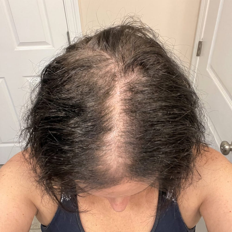 Semana 1